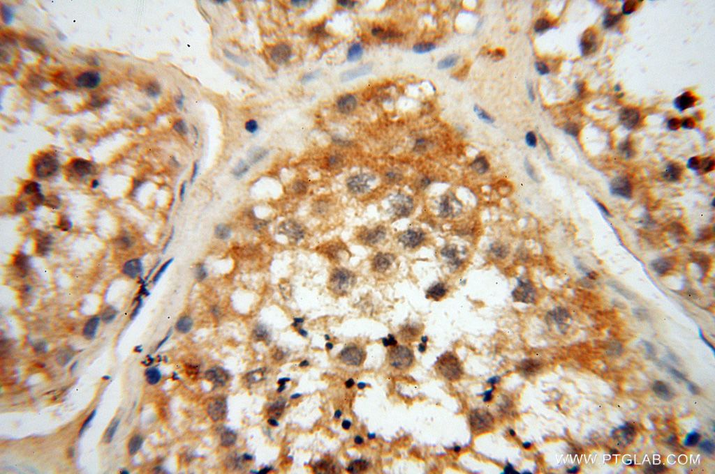 IHC staining of human testis using 17458-1-AP