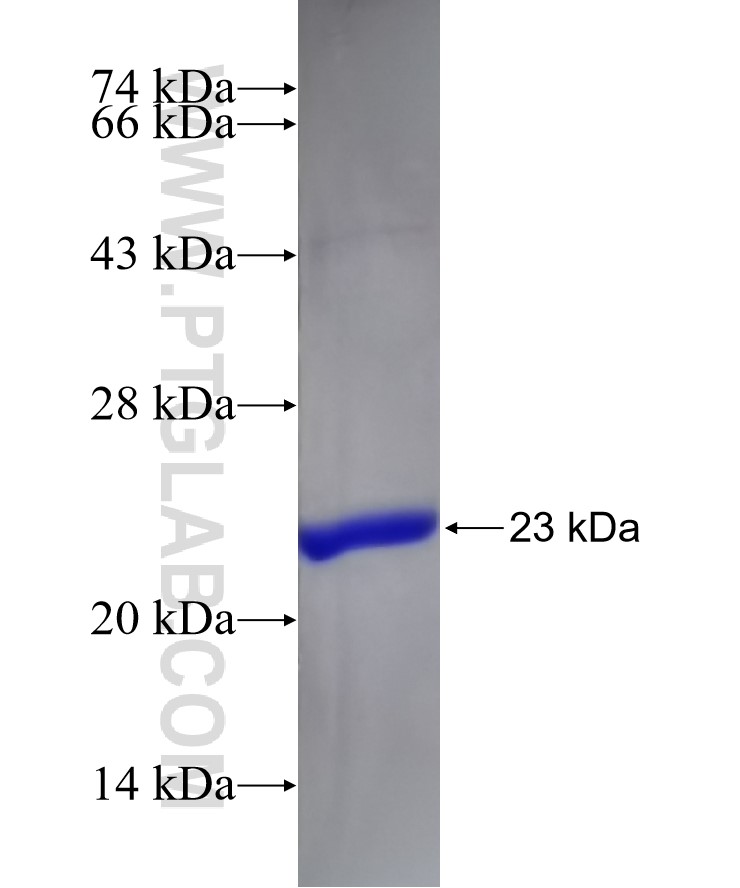 RTKN2 fusion protein Ag11098 SDS-PAGE