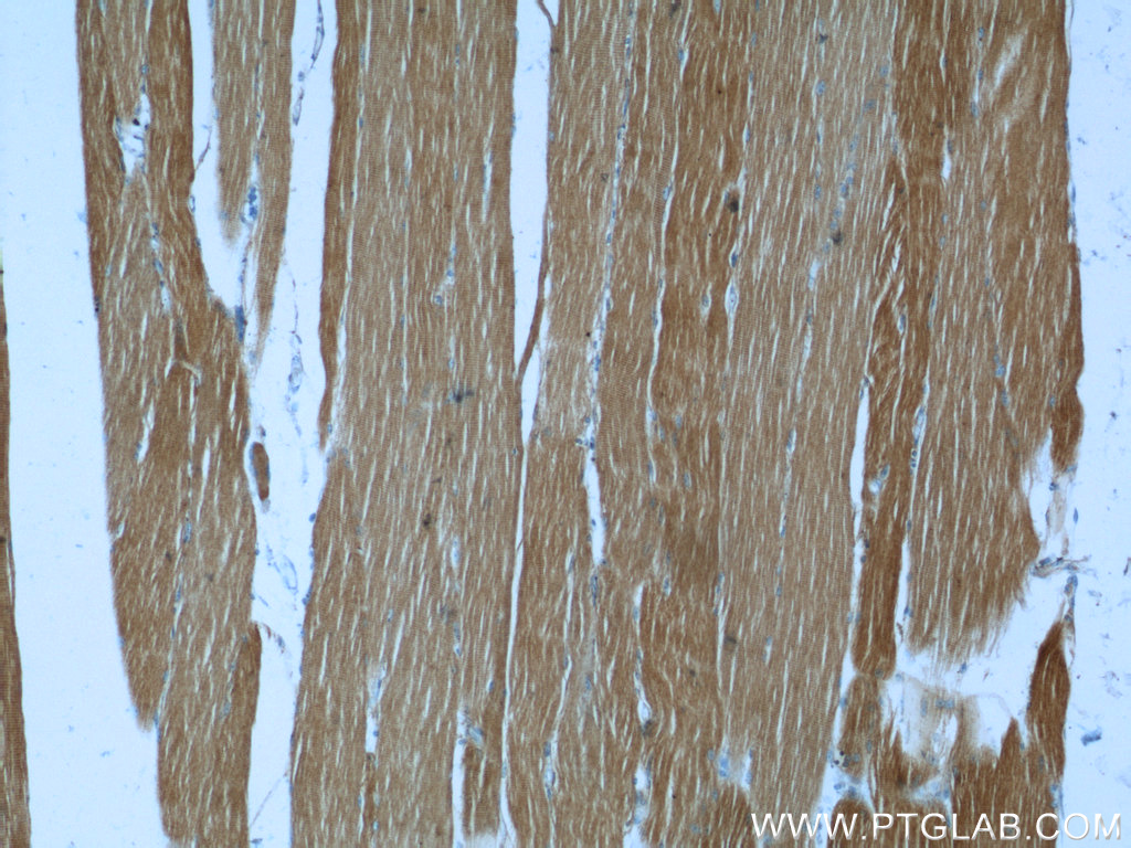 IHC staining of human skeletal muscle using 11168-1-AP (same clone as 11168-1-PBS)