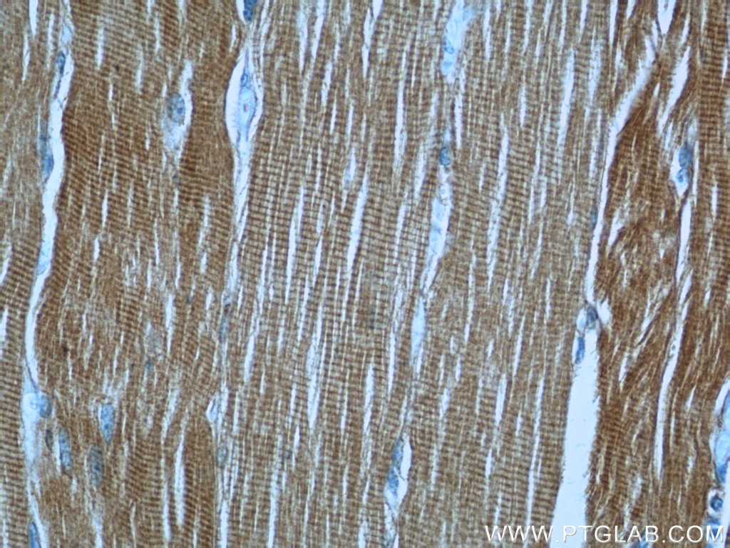 IHC staining of human skeletal muscle using 11168-1-AP (same clone as 11168-1-PBS)