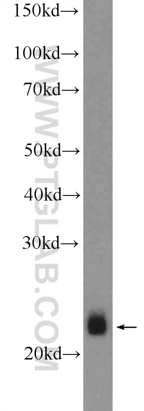 WB analysis of mouse skeletal muscle using 11168-1-AP (same clone as 11168-1-PBS)