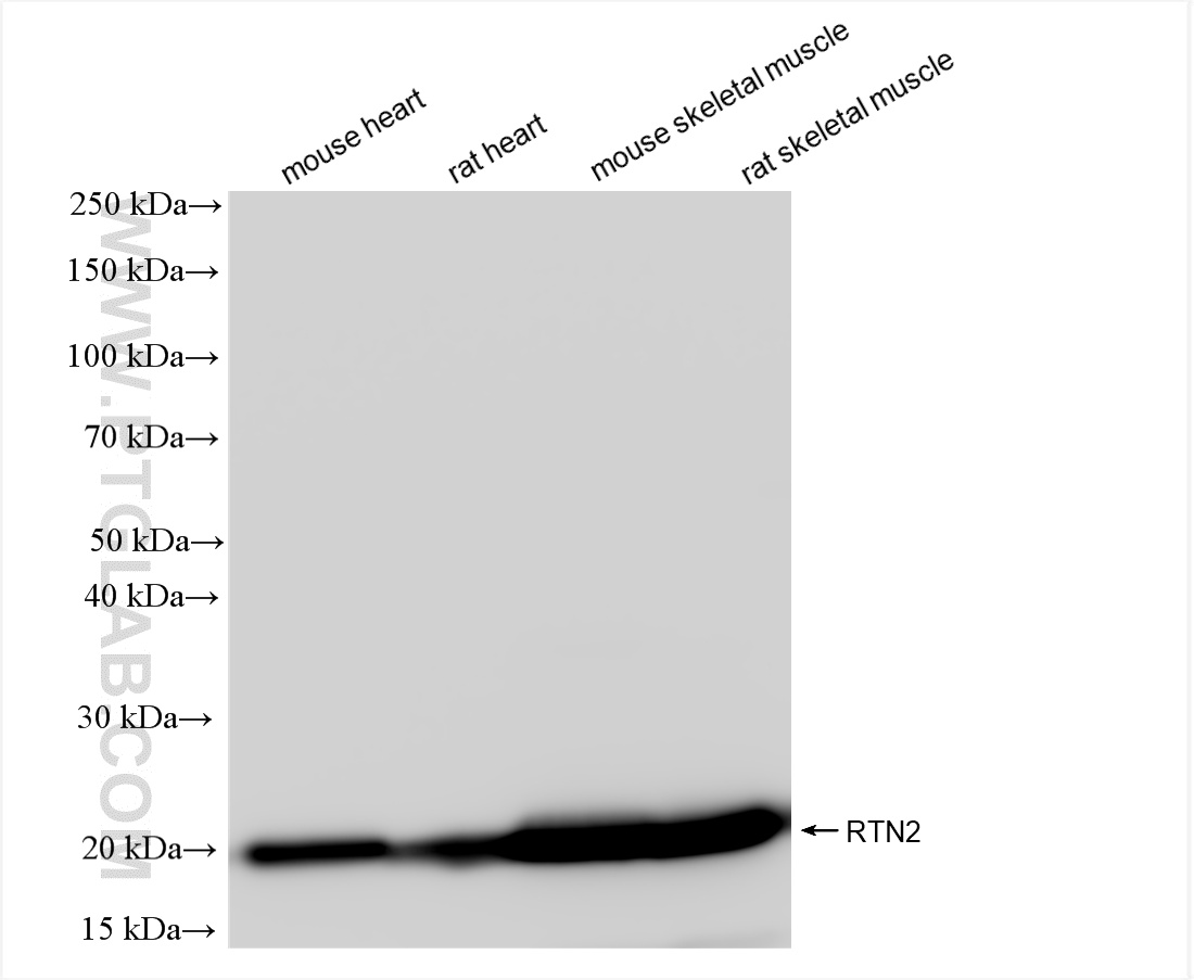 WB analysis using 86162-1-RR (same clone as 86162-1-PBS)