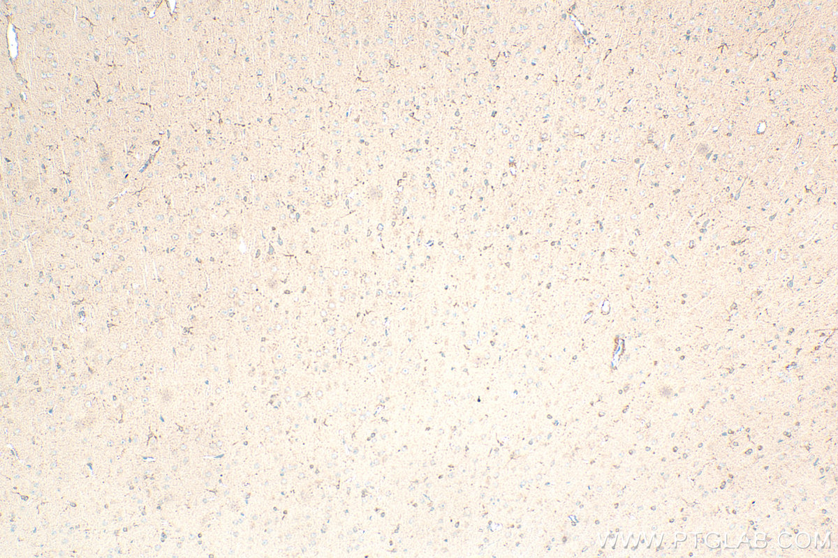 IHC staining of rat brain using 12055-2-AP IHC staining of rat brain using 12055-2-AP
