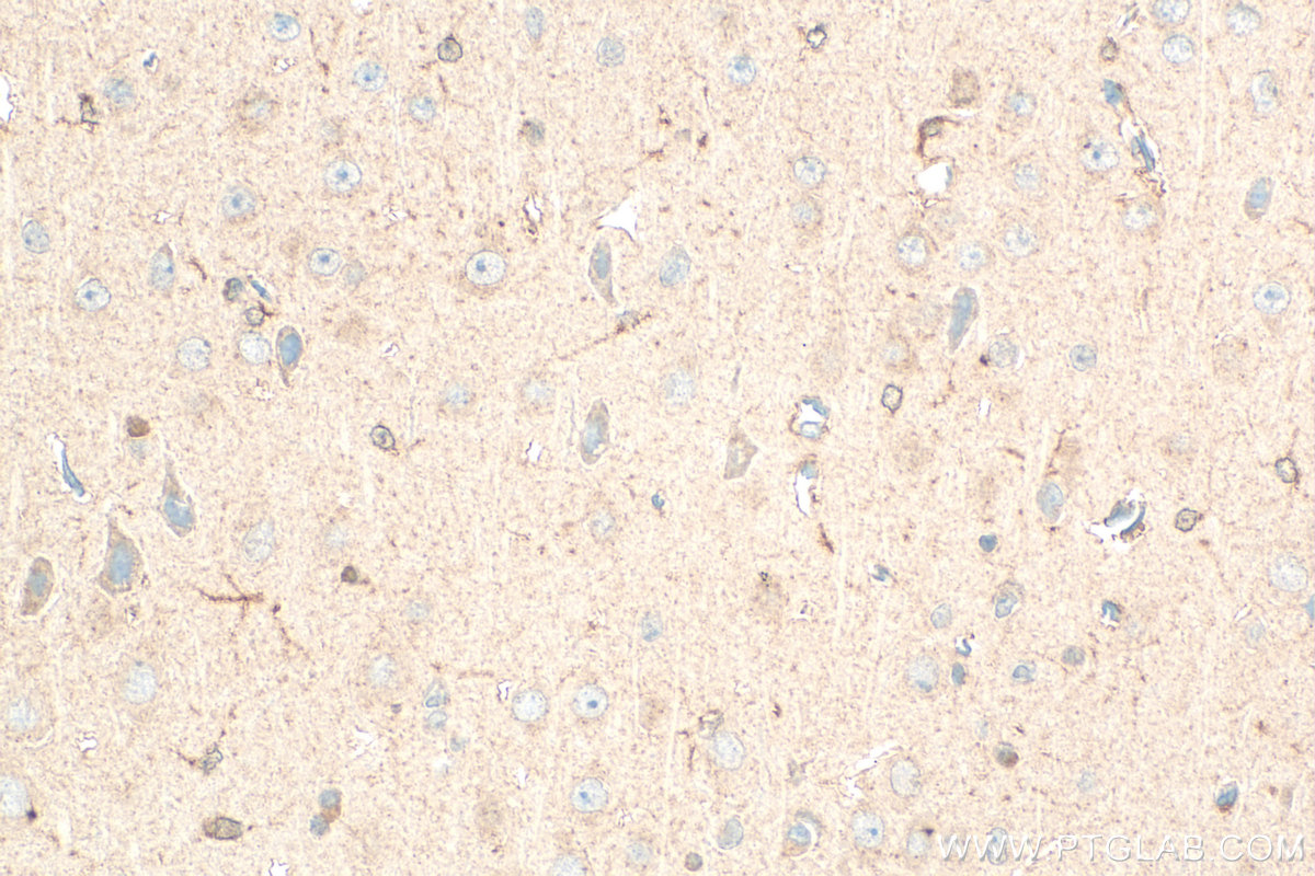 IHC staining of rat brain using 12055-2-AP IHC staining of rat brain using 12055-2-AP