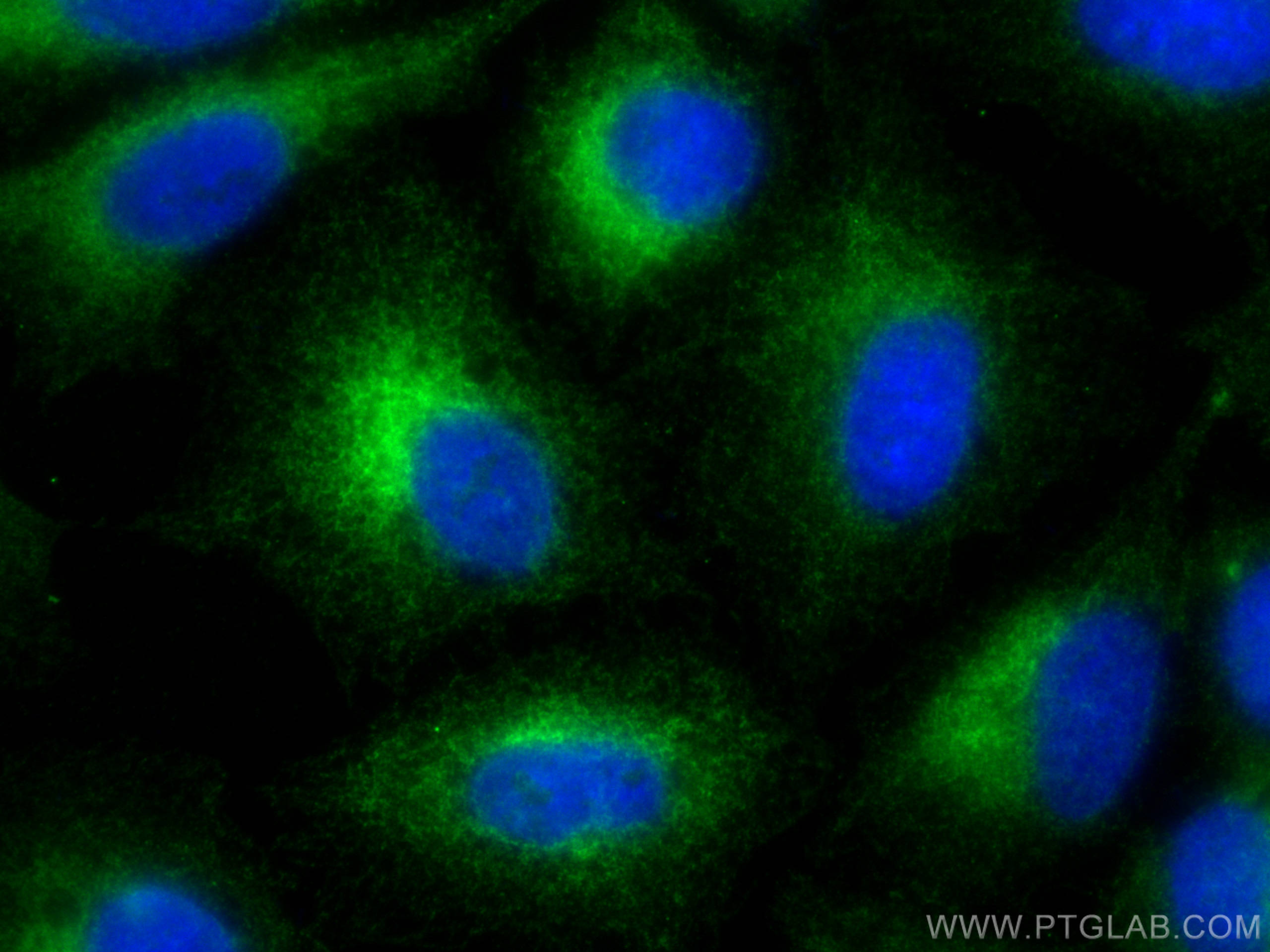 IF Staining of A549 using 10740-1-AP