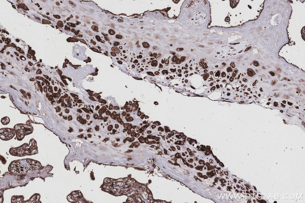 IHC staining of human placenta using 10950-1-AP