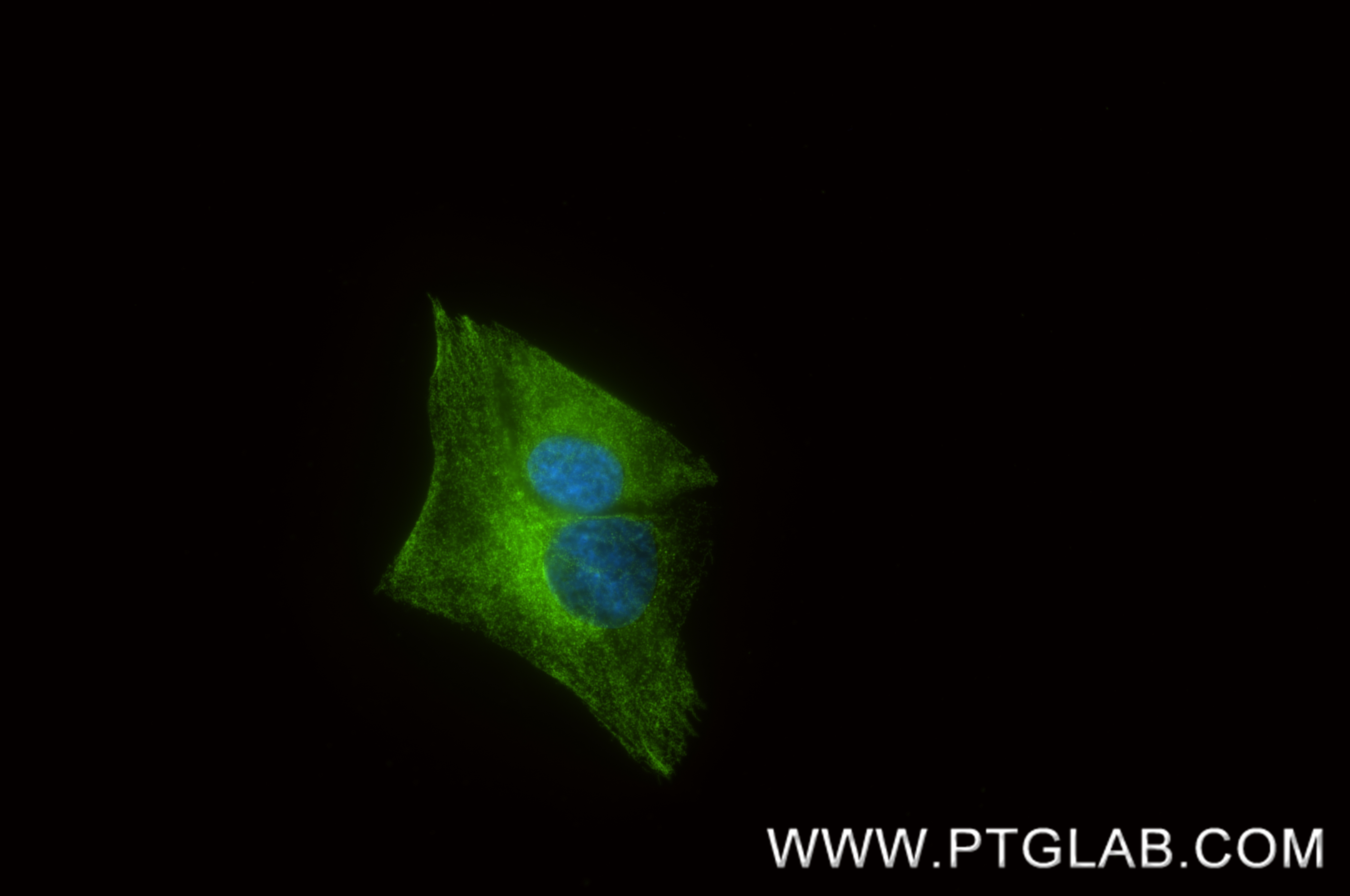 IF Staining of SH-SY5Y using 87573-2-RR IF Staining of SH-SY5Y using 87573-2-RR