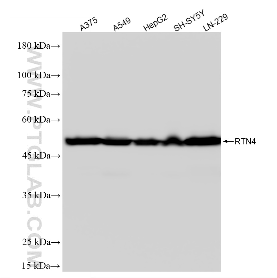 WB analysis using 87573-2-RR WB analysis using 87573-2-RR