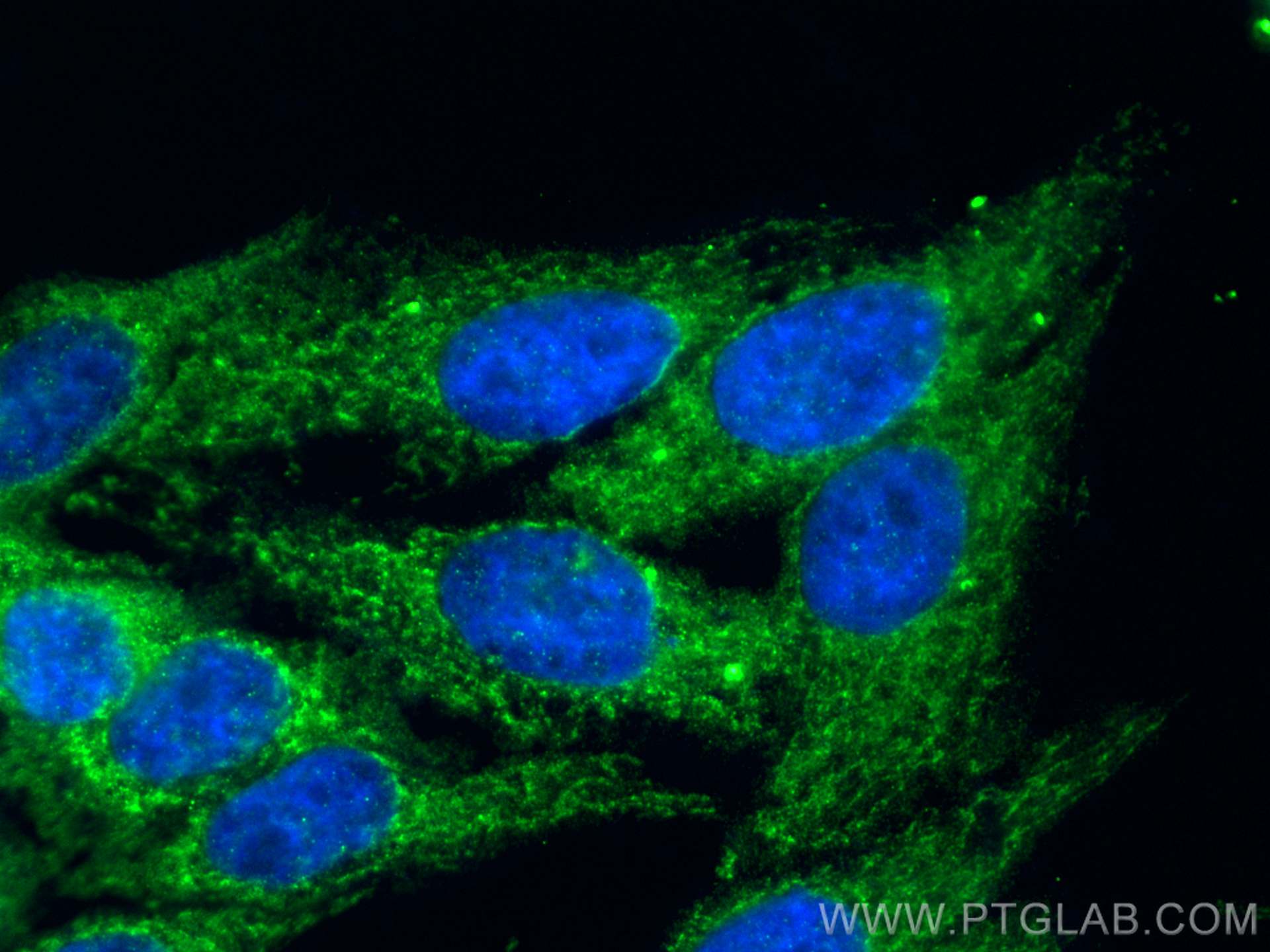 IF Staining of HepG2 using 15636-1-AP
