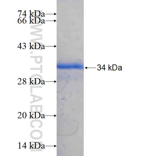 RTN4R fusion protein Ag26032 SDS-PAGE RTN4R fusion protein Ag26032 SDS-PAGE