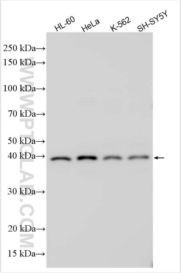 WB analysis using 26039-1-AP
