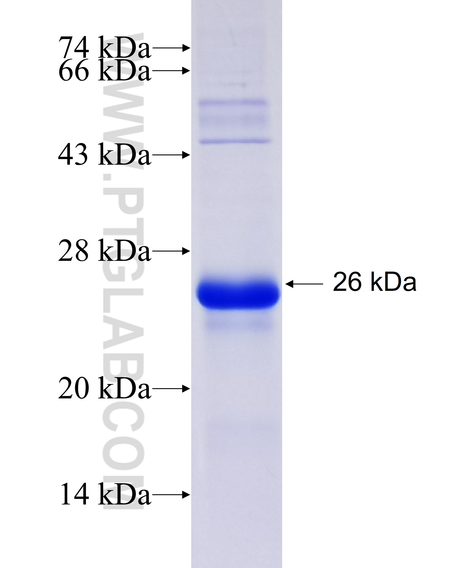 RTN4RL2 fusion protein Ag23747 SDS-PAGE RTN4RL2 fusion protein Ag23747 SDS-PAGE