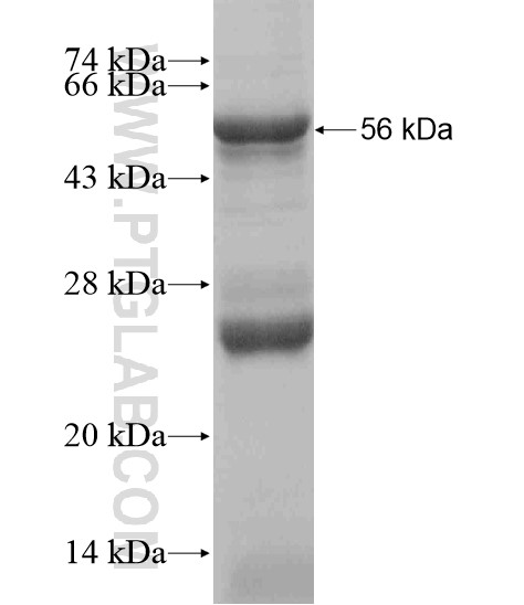 RTP3 fusion protein Ag18958 SDS-PAGE