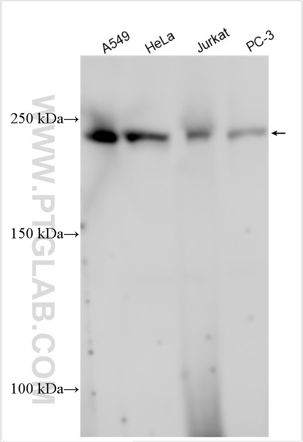 WB analysis using 31232-1-AP (same clone as 31232-1-PBS) WB analysis using 31232-1-AP (same clone as 31232-1-PBS)