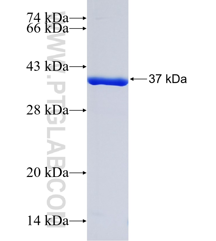 RTTN fusion protein Ag34960 SDS-PAGE RTTN fusion protein Ag34960 SDS-PAGE