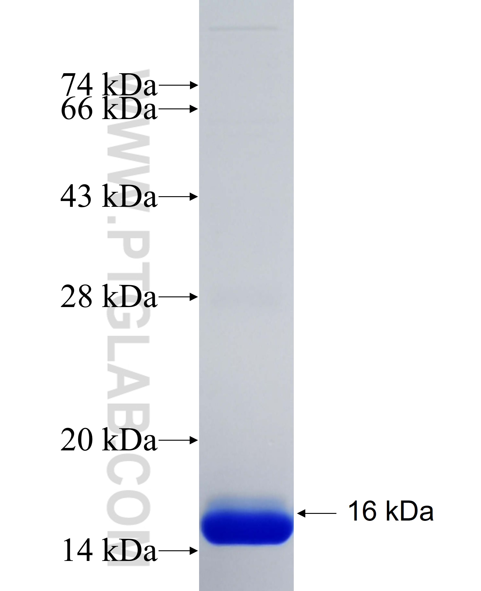 RTTN fusion protein Ag34988 SDS-PAGE RTTN fusion protein Ag34988 SDS-PAGE