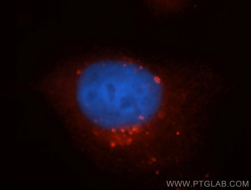 IF Staining of HeLa using 13498-1-AP (same clone as 13498-1-PBS)
