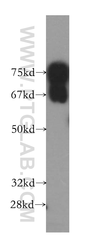 WB analysis of HeLa using 13498-1-AP (same clone as 13498-1-PBS)