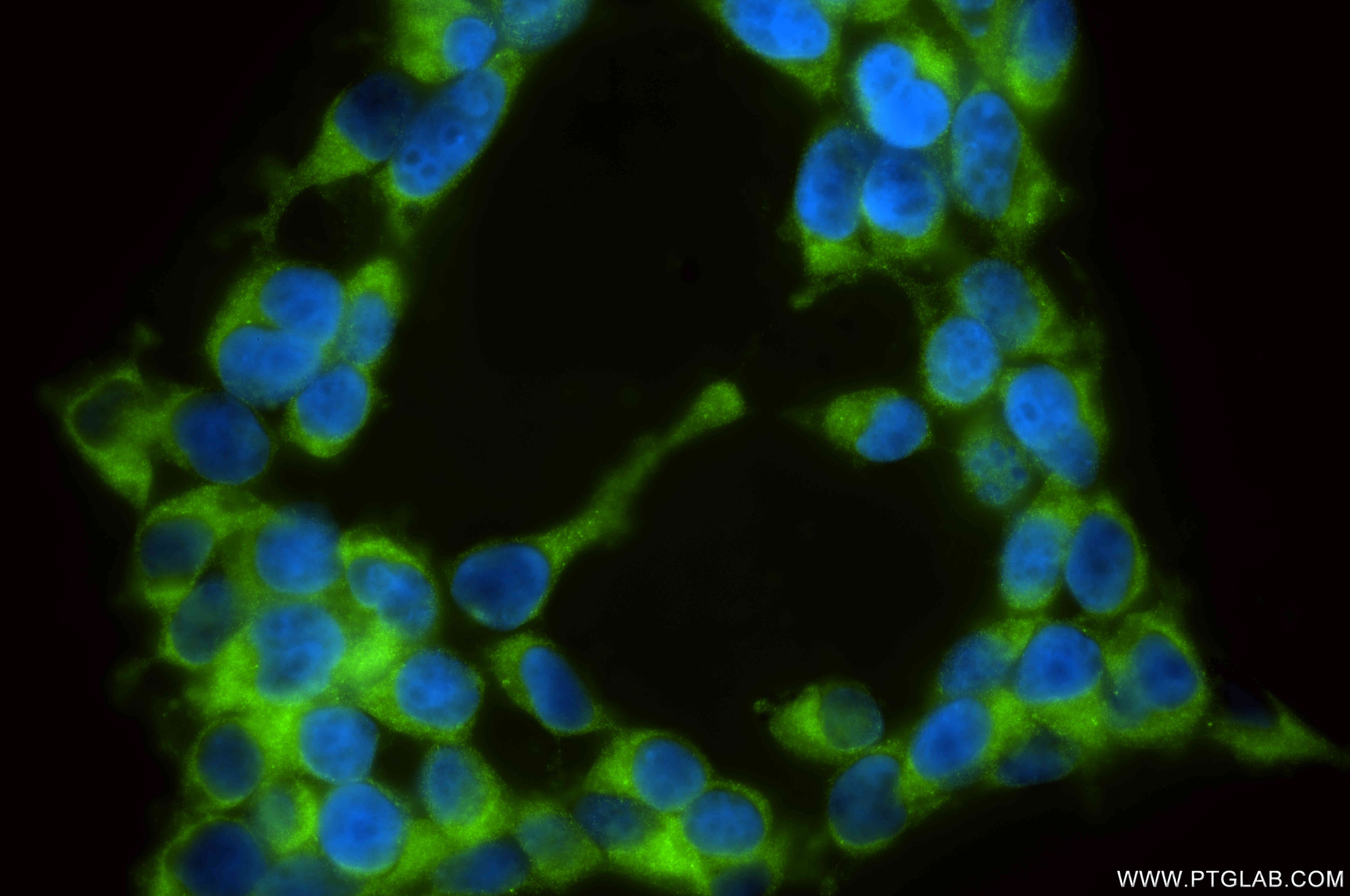 IF Staining of HEK-293 using 85839-4-RR (same clone as 85839-4-PBS)