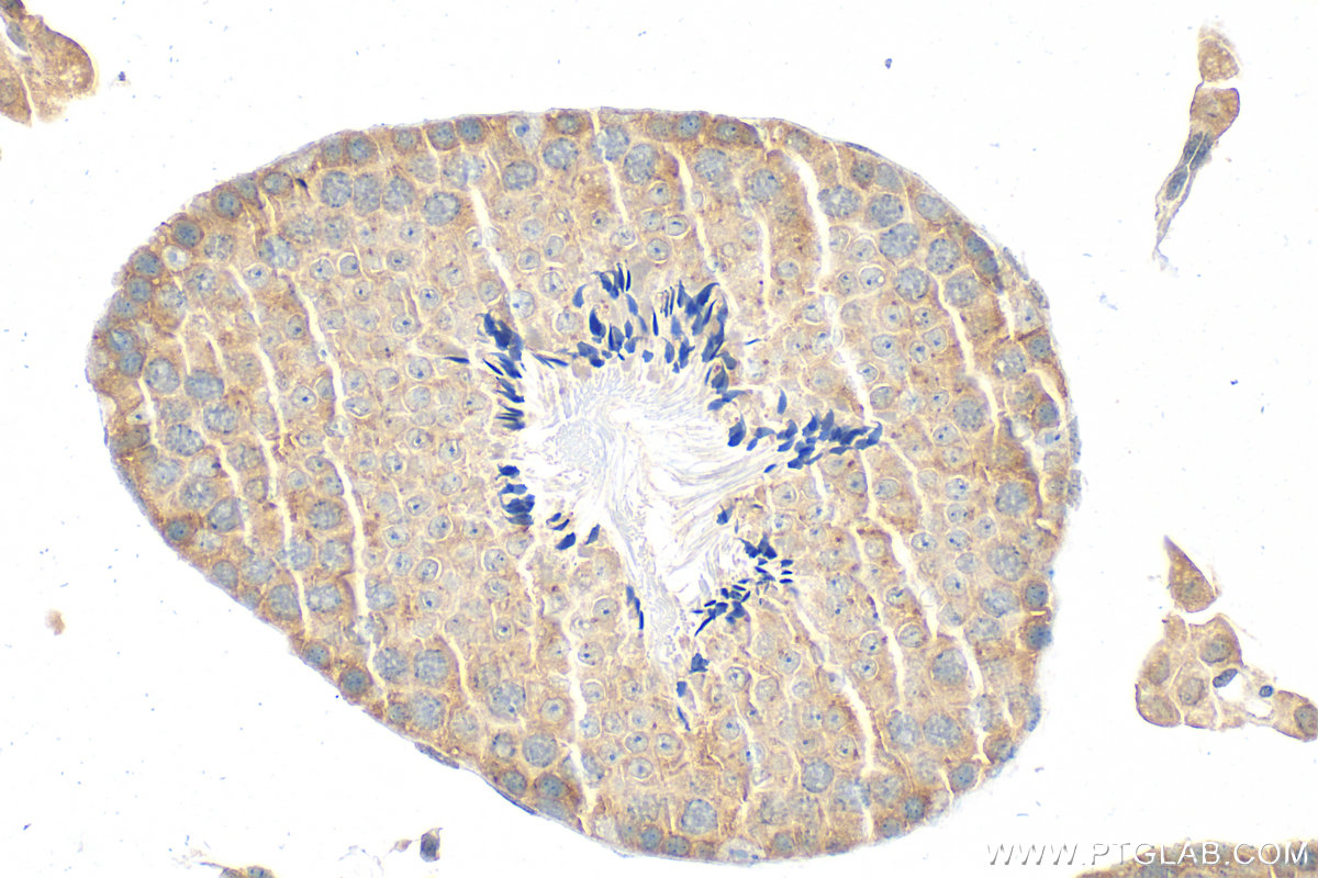 IHC staining of mouse testis using 15383-1-AP IHC staining of mouse testis using 15383-1-AP