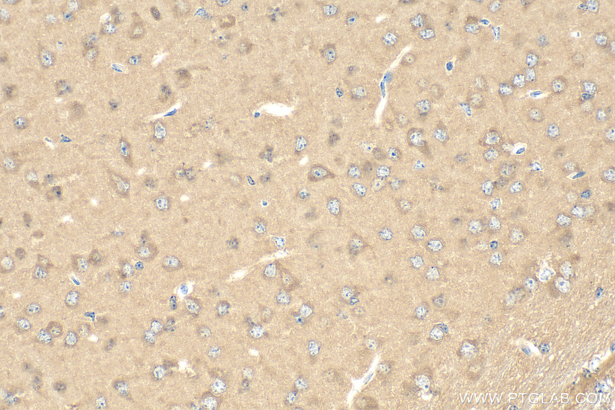 IHC staining of mouse brain using 15383-1-AP IHC staining of mouse brain using 15383-1-AP