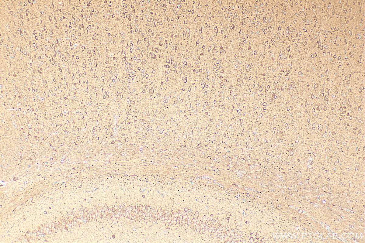 IHC staining of mouse brain using 20531-1-AP