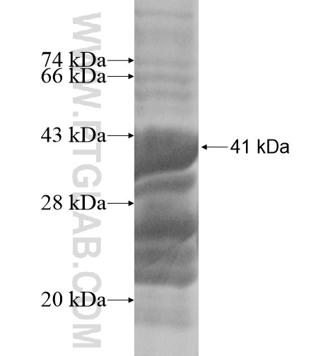 RUNDC3A fusion protein Ag14393 SDS-PAGE