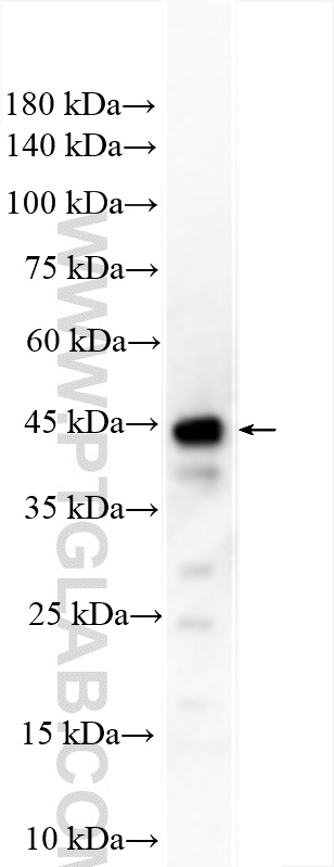 mouse brain tissue were subjected to SDS PAGE followed by western blot with 17113-1-AP (RUNDC3B antibody) at dilution of 1:1000 incubated at room temperature for 1.5 hours. WB analysis of mouse brain using 17113-1-AP