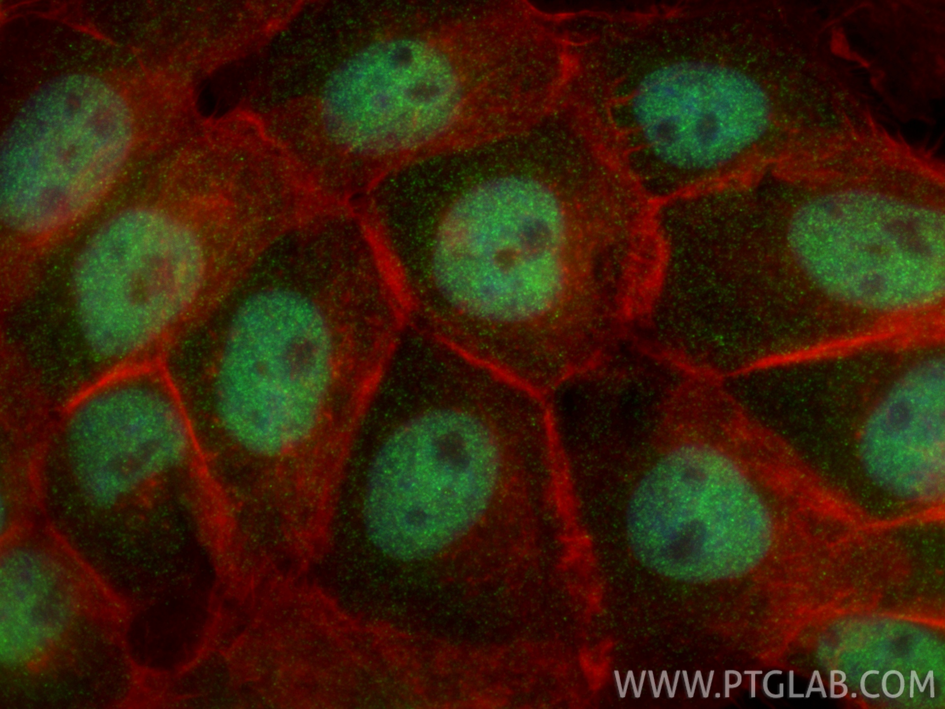 IF Staining of U-251 using 25315-1-AP