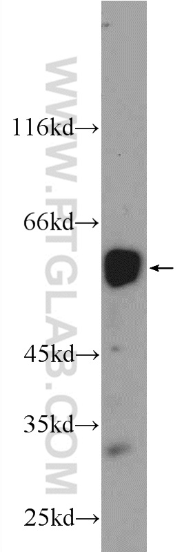 RUNX1 (middle) Polyclonal antibody