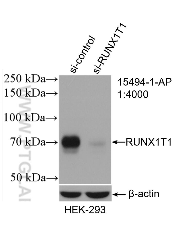 WB analysis of HEK-293 using 15494-1-AP