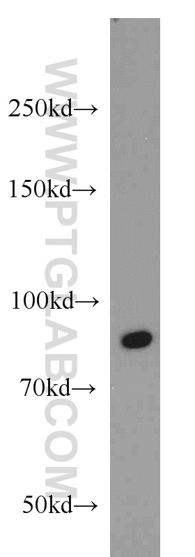 WB analysis of HepG2 using 15494-1-AP