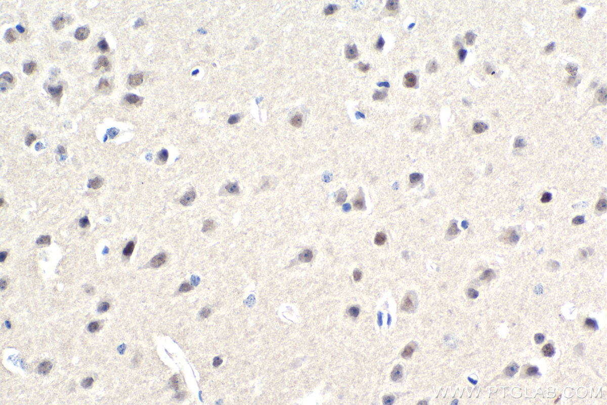 IHC staining of mouse brain using 67086-1-Ig