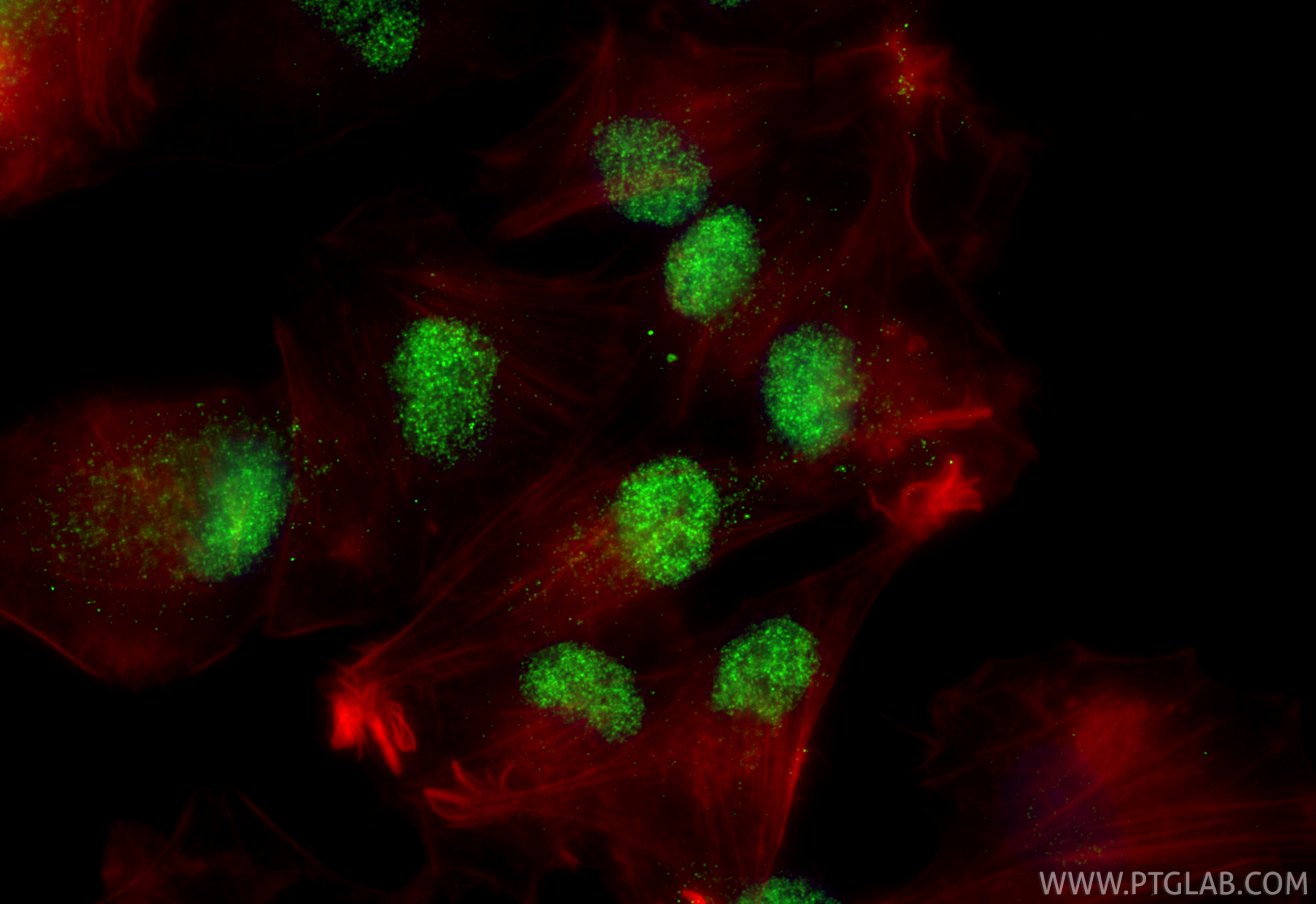 IF Staining of ROS1728 using 20700-1-AP