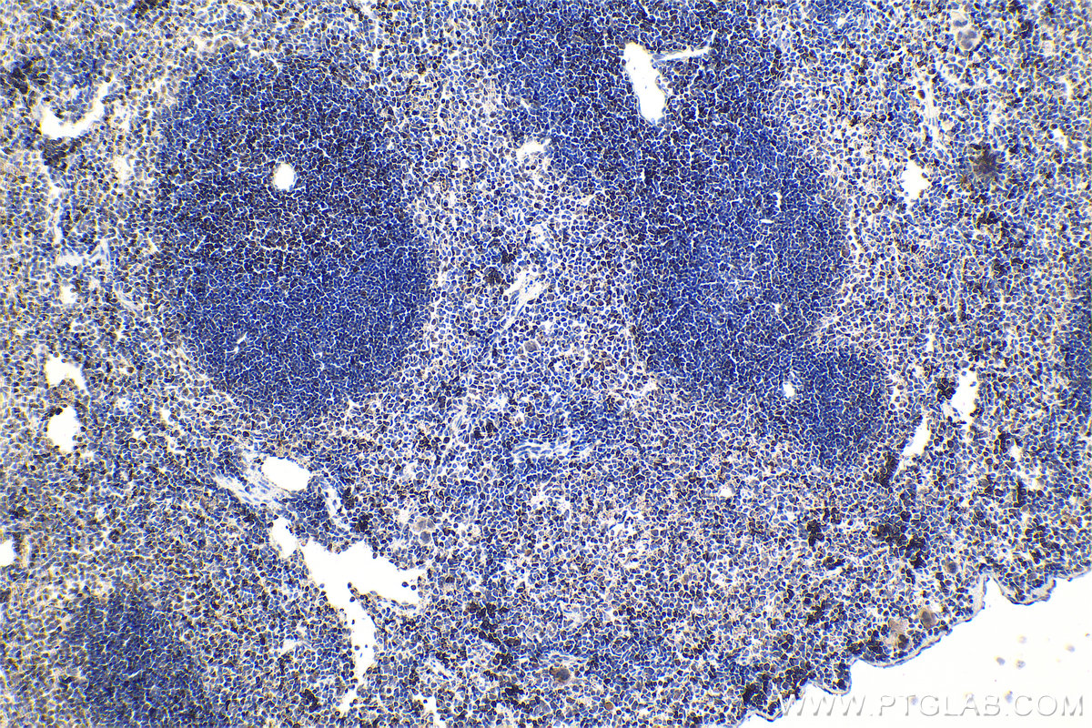 IHC staining of mouse spleen using 27099-1-AP IHC staining of mouse spleen using 27099-1-AP