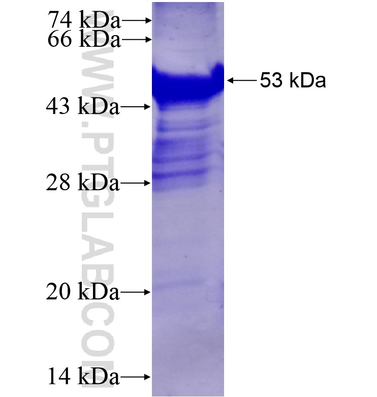 RUNX3 fusion protein Ag13066 SDS-PAGE RUNX3 fusion protein Ag13066 SDS-PAGE