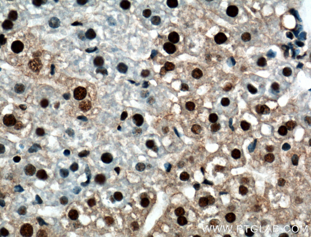 IHC staining of mouse liver using 10210-2-AP