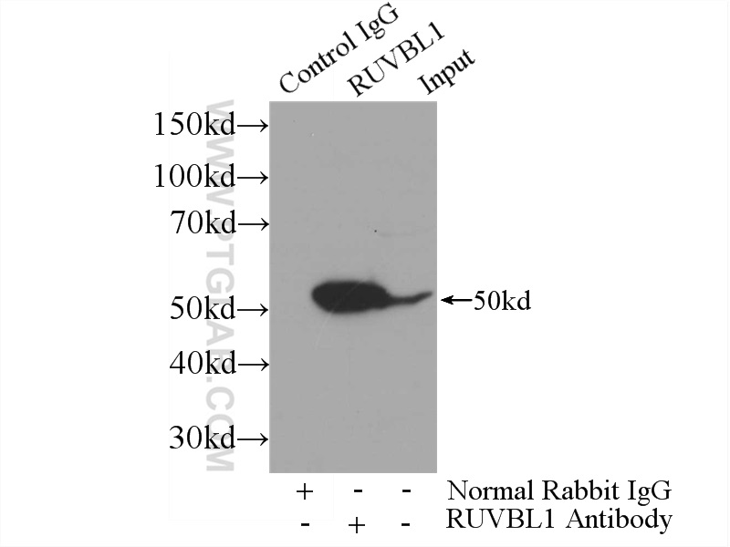 IP experiment of HeLa using 10210-2-AP