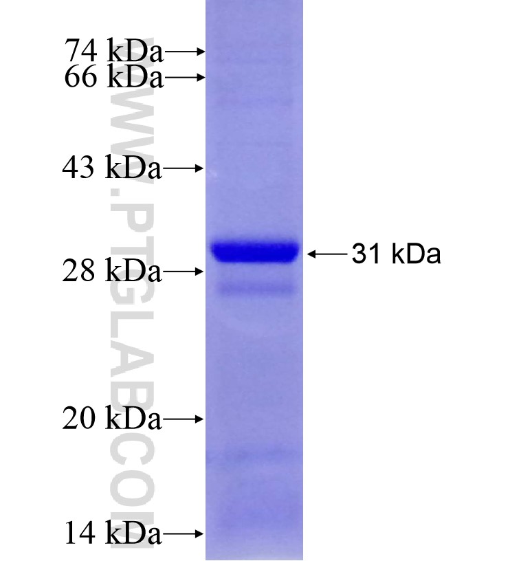 RUVBL1 fusion protein Ag16688 SDS-PAGE