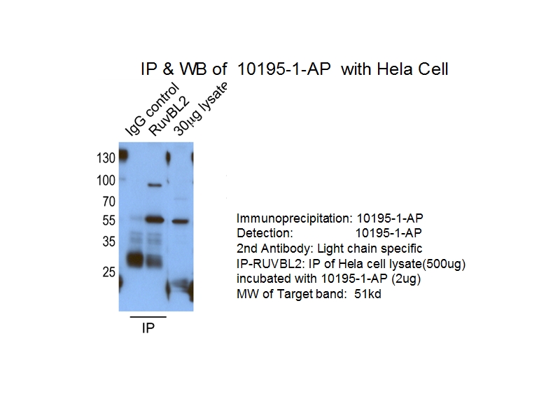 IP experiment of HeLa cells using 10195-1-AP