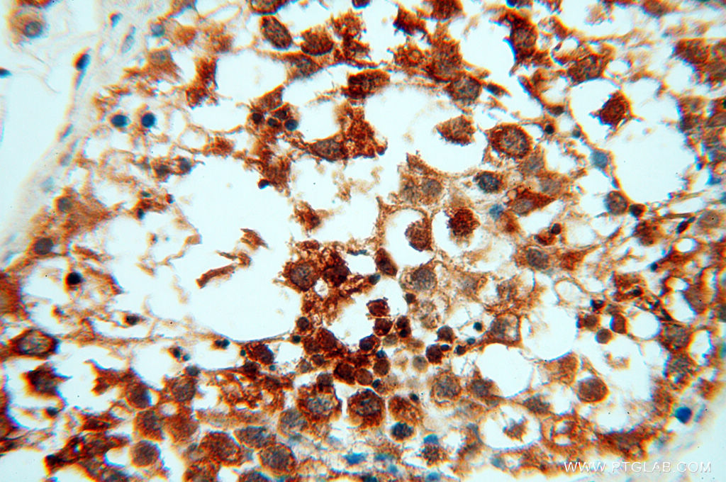IHC staining of human testis using 10195-1-AP