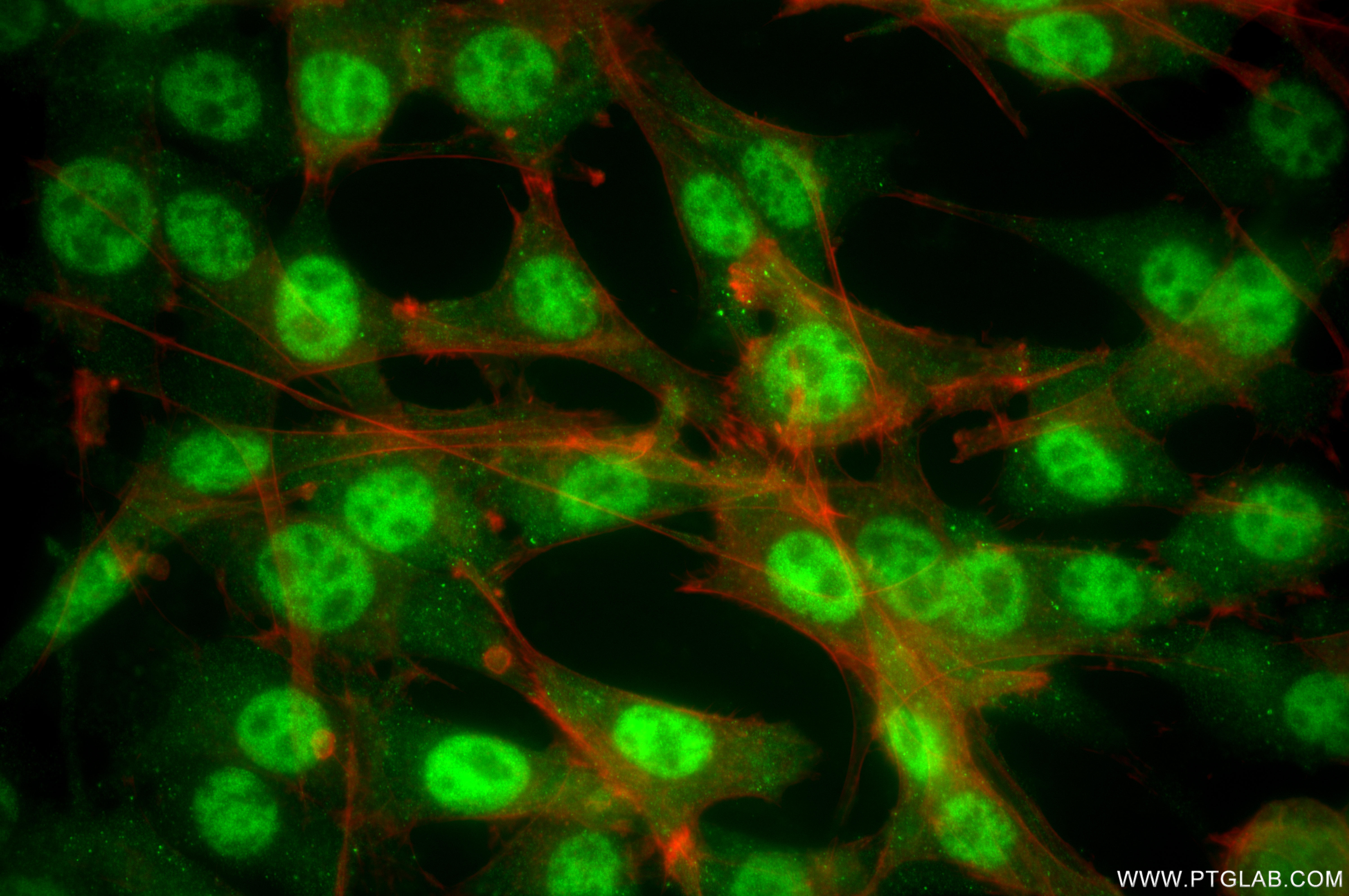 IF Staining of NIH/3T3 using 87557-1-RR (same clone as 87557-1-PBS)