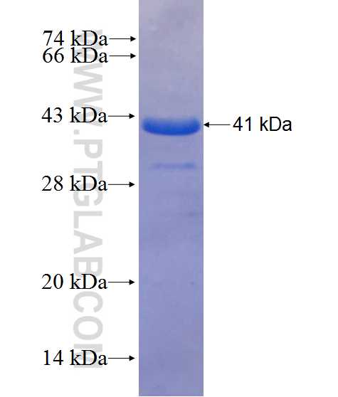 RWDD1 fusion protein Ag10504 SDS-PAGE