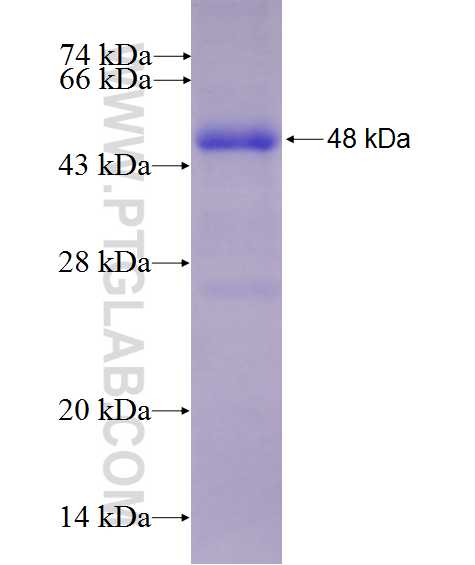 RWDD2B fusion protein Ag27126 SDS-PAGE RWDD2B fusion protein Ag27126 SDS-PAGE
