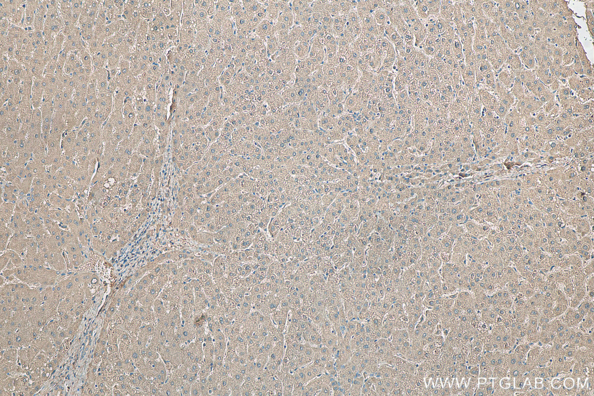 IHC staining of human liver using 22737-1-AP