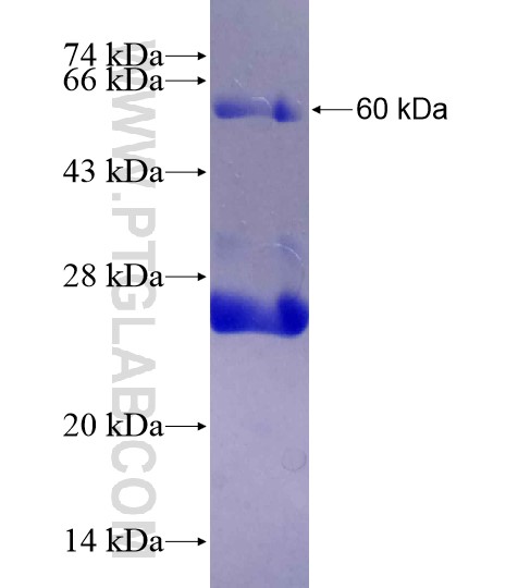 RXFP2 fusion protein Ag18620 SDS-PAGE RXFP2 fusion protein Ag18620 SDS-PAGE