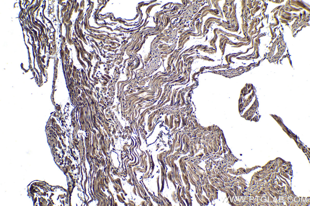 IHC staining of mouse heart using 21218-1-AP
