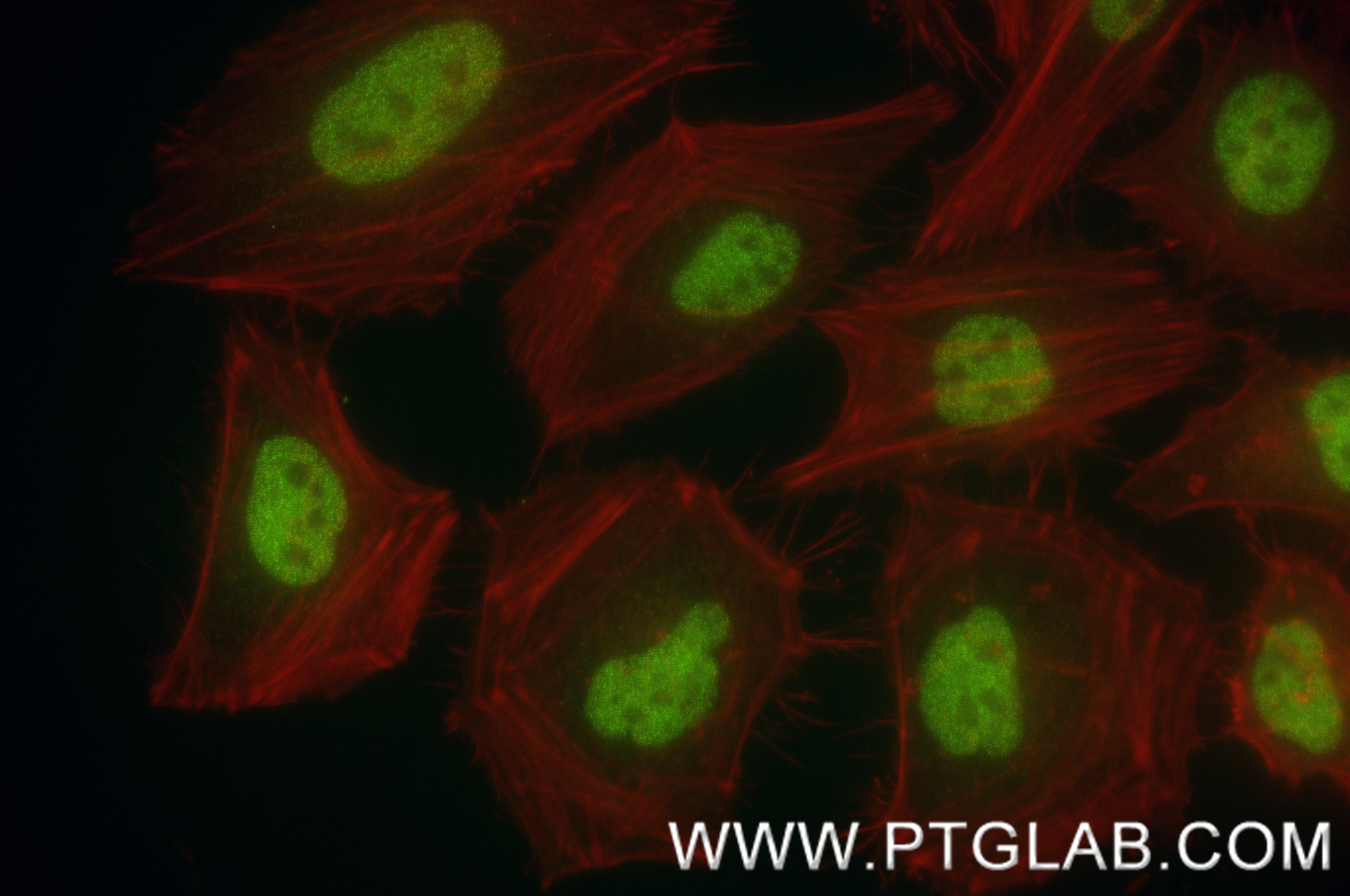 IF Staining of HeLa using 83796-5-RR (same clone as 83796-5-PBS)
