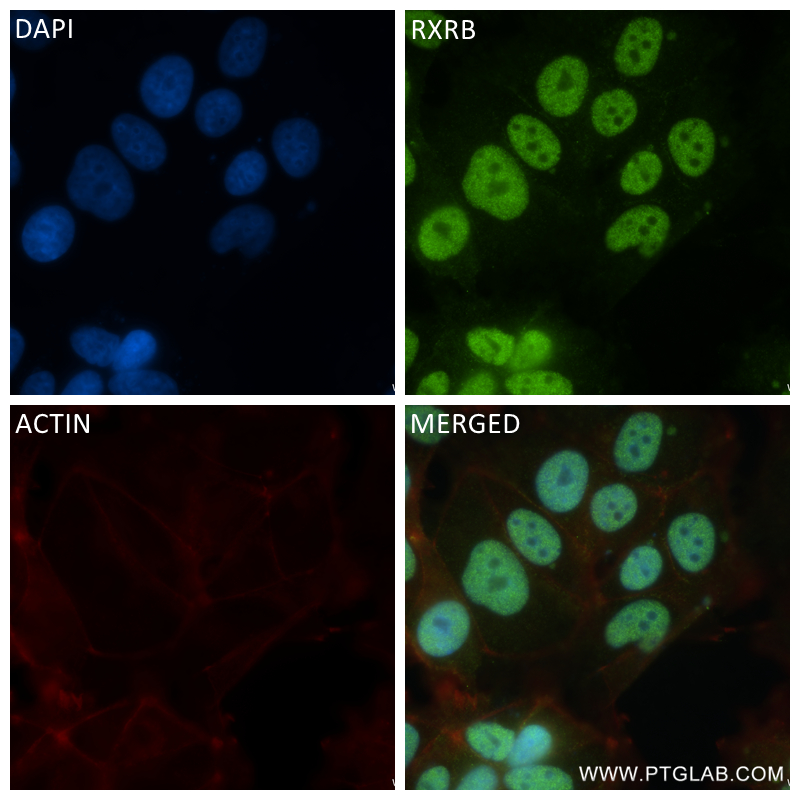 IF Staining of MCF-7 using 84656-4-RR (same clone as 84656-4-PBS)