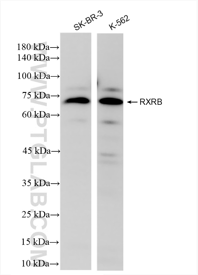WB analysis using 84656-4-RR (same clone as 84656-4-PBS)